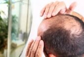 Loosing Hair Don’t Worry FEG Plus Hair Growth Spray