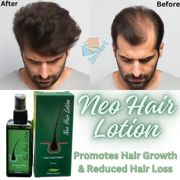 Hair Loss Don’t Worry