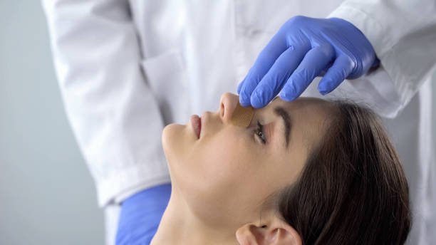 Rhinoplasty surgery in Riyadh