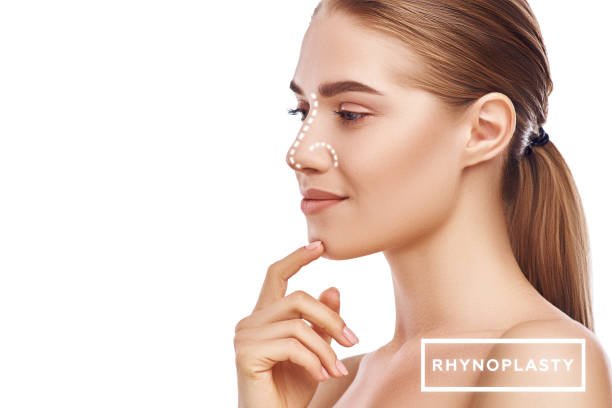 Rhinoplasty surgery in Riyadh