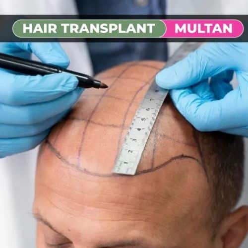Dot Clinics Skin Hair Transplant Aesthetic