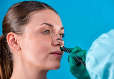 Best-rhinoplasty-surgeon-in-Riyadh-8