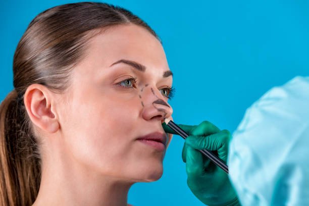 Best rhinoplasty surgeon in Riyadh