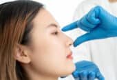 Best rhinoplasty surgeon in Riyadh