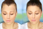 Hair Transplants in Riyadh