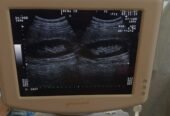 Ultrasound machine for sale, contact; 0302-5698121
