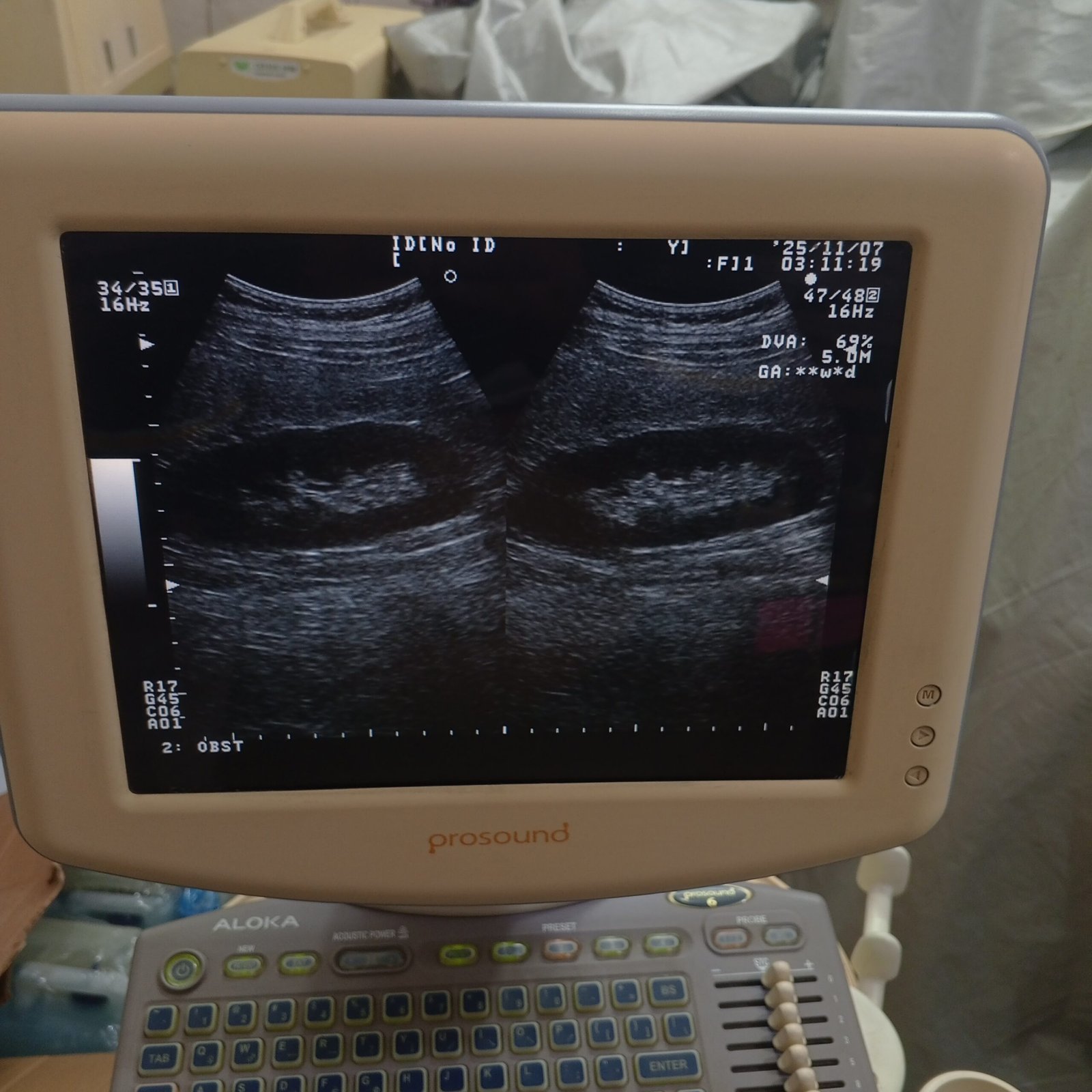 Ultrasound machine for sale, contact; 0302-5698121
