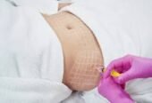 London Aesthetics & Rejuvenation Centre