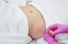 London Aesthetics & Rejuvenation Centre
