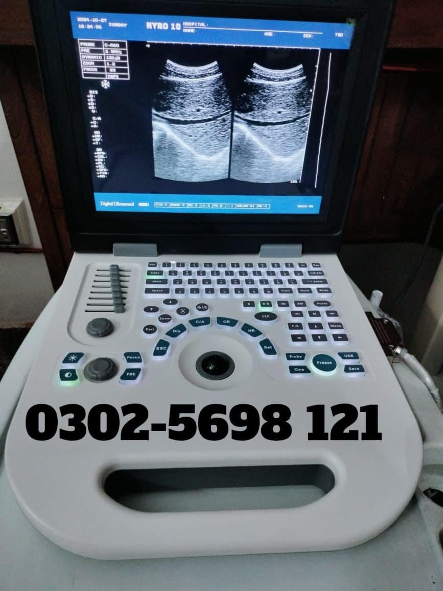 Nyro10 and D30 ultrasound machine available,
