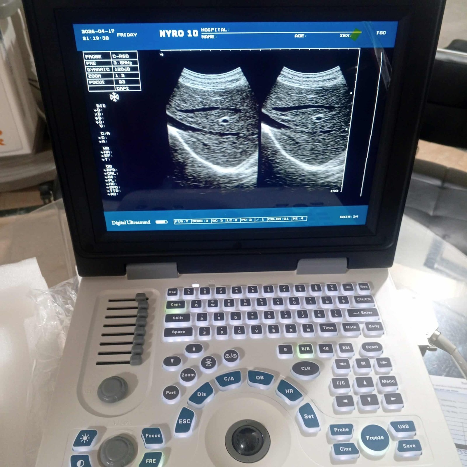 Nyro10 brand new ultrasound machine available
