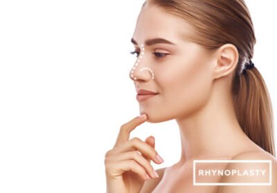 Rhinoplasty-in-Riyadh-4