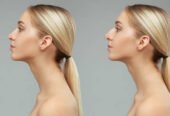 Rhinoplasty surgery in Riyadh