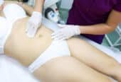 Liposuction in Riyadh