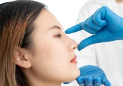 Rhinoplasty-surgery-in-Riyadh-11