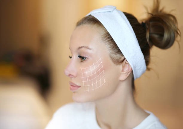 Face Lift IN Riyadh
