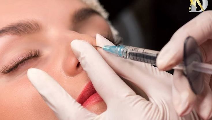 Closed Rhinoplasty Riyadh Cons?