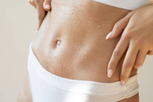 Tummy Tuck surgery in Riyadh