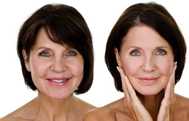 Facelift in Riyadh