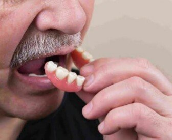 DENTURE MAKING AND REPAIR