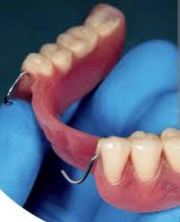 DENTURE MAKING AND REPAIR