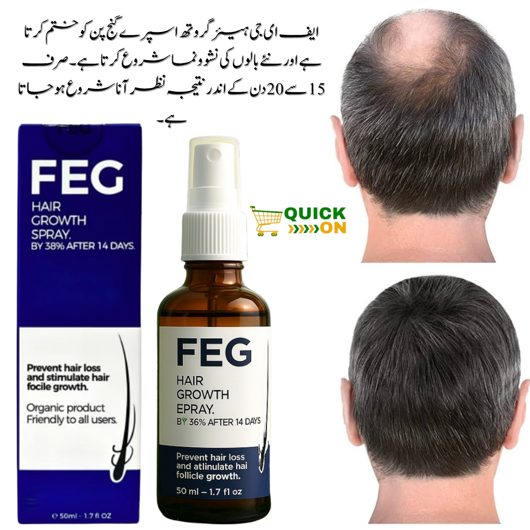 FEG Plus Hair Growth Spray in Karachi – 03001819306