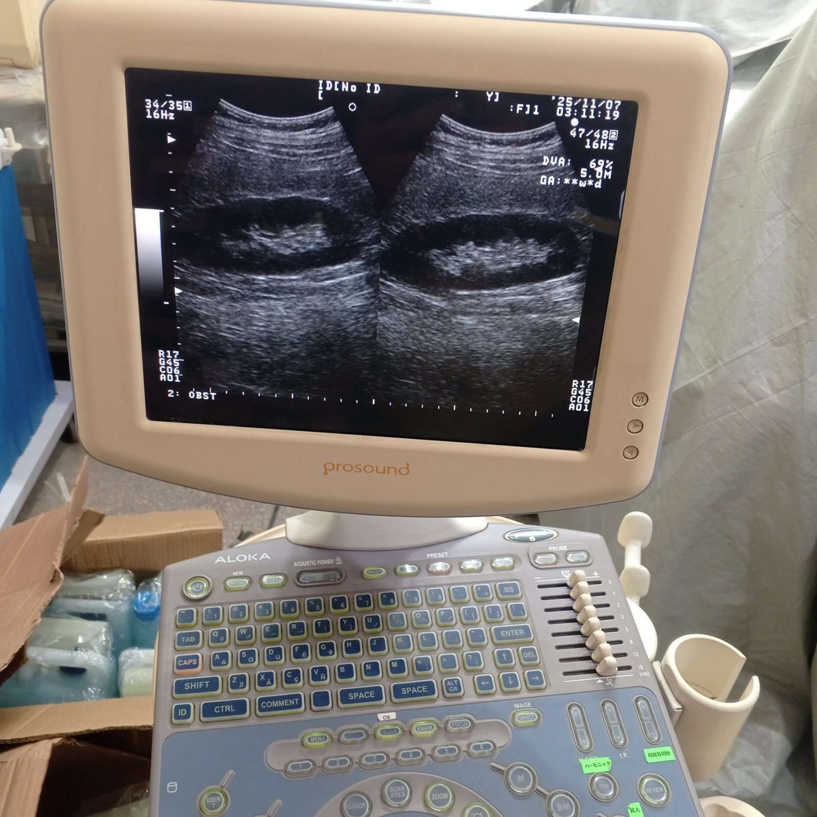 Ultrasound machine for sale, contact; 0302-5698121