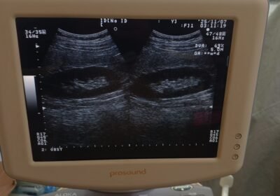 IMG_20251106_151151_957